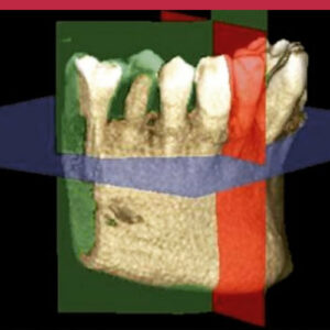 Curso de Diagnóstico Máxilofacial con Tomografía Computada Cone Beam