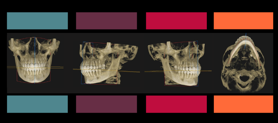 ¡Soy ortodoncista! ¿Cómo evalúo la tomografía de mi paciente?