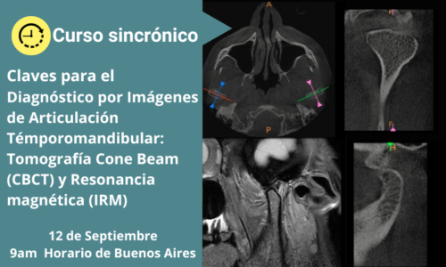CLAVES PARA EL DIAGNÓSTICO POR IMÁGENES DE ARTICULACIÓN TÉMPOROMANDIBULAR: TOMOGRAFÍA CONE BEAM (CBCT) Y RESONANCIA MAGNÉTICA (IRM)